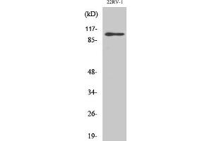 Western Blot analysis of various cells using GluR-2 Polyclonal Antibody. (GRIA2 抗体)