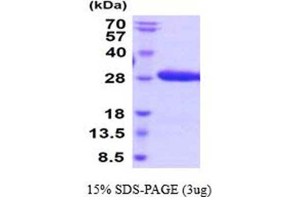 Ephrin B3 Protein (EFNB3) (AA 28-226) (His tag)