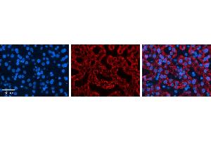 CTAGE5 antibody - middle region          Formalin Fixed Paraffin Embedded Tissue:  Human Liver Tissue    Observed Staining:  Cytoplasm in hepatocytes   Primary Antibody Concentration:  1:600    Secondary Antibody:  Donkey anti-Rabbit-Cy3    Secondary Antibody Concentration:  1:200    Magnification:  20X    Exposure Time:  0. (MIA2 抗体  (Middle Region))