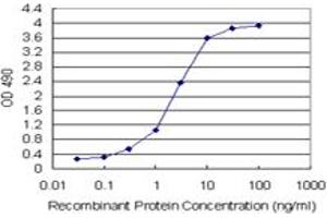 Sandwich ELISA detection sensitivity ranging from 0. (PNMA1 (人) Matched Antibody Pair)