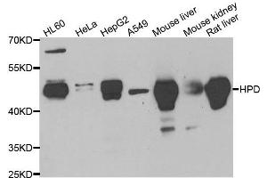 Western blot analysis of extracts of various cell lines, using HPD antibody. (HPD 抗体)