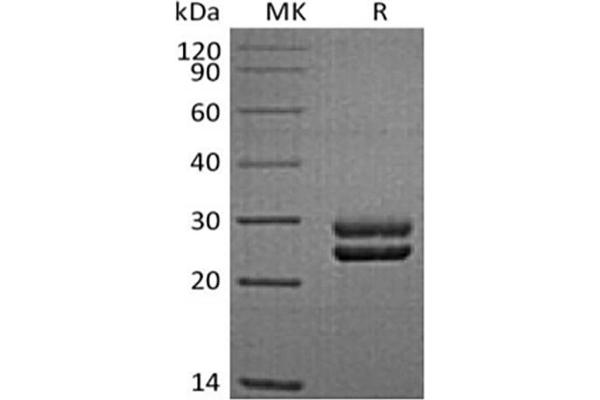 Prolactin Protein (PRL) (His tag)