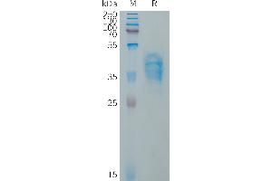 Human VWF(1596-1668) Protein, hFc Tag on SDS-PAGE under reducing condition. (VWF Protein (Fc Tag))