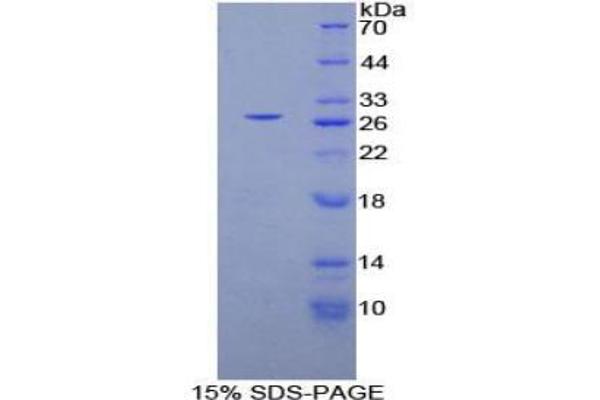 Phospholipase C gamma 1 蛋白