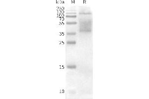 Western Blotting (WB) image for Tetraspanin 26 (TSPAN26) protein (ABIN7491580)