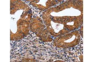 Immunohistochemistry (IHC) image for anti-GATA Binding Protein 6 (GATA6) antibody (ABIN2431397) (GATA6 抗体)