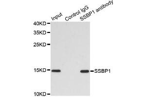 Immunoprecipitation analysis of 200 μg extracts of MCF7 cells using 1 μg SSBP1 antibody (ABIN5974202). (SSBP1 抗体)