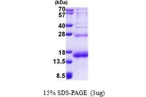 RPS19 Protein (AA 1-145) (His tag)