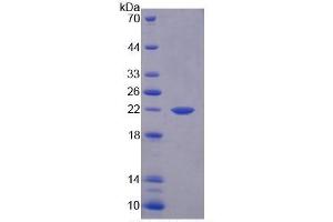 SDS-PAGE (SDS) image for Interleukin 1 alpha (IL1A) ELISA Kit (ABIN6730939)