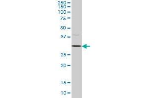 CDK4 monoclonal antibody (M08A), clone 3E7 Western Blot analysis of CDK4 expression in HeLa . (CDK4 抗体  (AA 211-303))