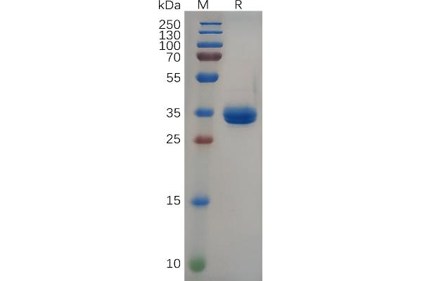 Gastrin-Releasing Peptide Protein (GRP) (AA 24-50) (Fc Tag)