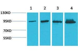 Western Blotting (WB) image for anti-Catenin, beta (CATNB) antibody (ABIN3181549) (beta Catenin 抗体)