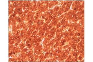 Image no. 1 for anti-alpha-Fetoprotein (AFP) antibody (ABIN950378) (alpha Fetoprotein 抗体)