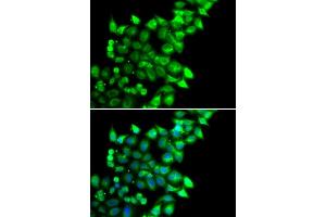 Immunofluorescence analysis of U20S cell using MEST antibody. (MEST 抗体)