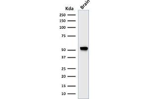 Western Blotting (WB) image for anti-Glial Fibrillary Acidic Protein (GFAP) antibody (ABIN6939508)