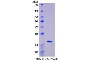 SDS-PAGE analysis of Rat Thioredoxin Protein. (TXN 蛋白)