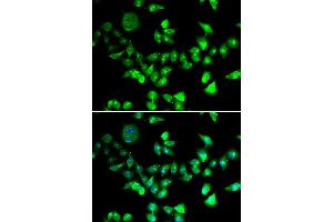 Immunofluorescence analysis of U2OS cells using SMC1A antibody. (SMC1A 抗体)