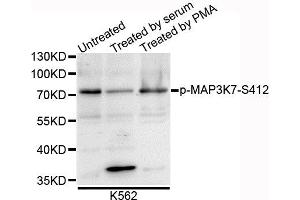 Western blot analysis of extracts of K562 cells, using Phospho-MAP3K7-S412 antibody. (MAP3K7 抗体  (pSer439))