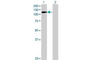 Western Blotting (WB) image for EXO1 293T Cell Transient Overexpression Lysate(Denatured) (ABIN1334421)