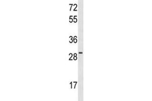 Western blot analysis of HES6 antibody and MCF-7 lysate. (HES6 抗体  (AA 6-34))