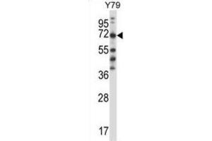 Western Blotting (WB) image for anti-Phenylalanyl-tRNA Synthetase, beta Subunit (FARSB) antibody (ABIN2997725) (FARSB 抗体)