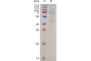Human  LIPG Protein, His Tag on SDS-PAGE under reducing condition. (LIPG Protein (AA 21-500) (His tag))