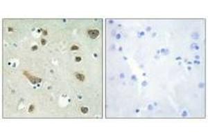 Immunohistochemistry analysis of paraffin-embedded human brain tissue using 14-3-3 γ antibody. (14-3-3 gamma 抗体)