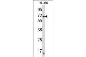 Western blot analysis in HL-60 cell line lysates (35ug/lane). (ZNF415 抗体  (N-Term))