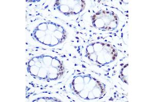 Immunohistochemistry of paraffin-embedded human colon using // Rabbit mAb (ABIN7265650) at dilution of 1:100 (40x lens). (APEX1 抗体)