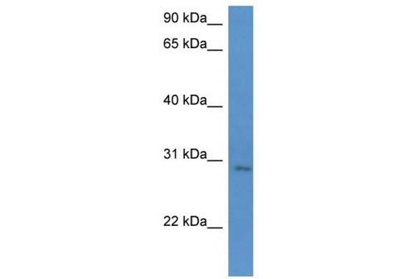 UTP23 抗体  (C-Term)