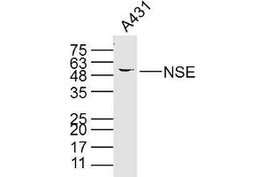 A431 cell lysates probed with PNSE (15E2) Monoclonal Antibody, unconjugated (bsm-33072M) at 1:300 overnight at 4°C followed by a conjugated secondary antibody for 60 minutes at 37°C. (ENO2/NSE 抗体)