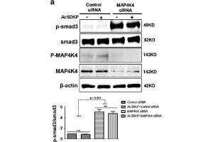 Western Blotting (WB) image for anti-SMAD, Mothers Against DPP Homolog 3 (SMAD3) (AA 417-425), (pSer423), (pSer425) antibody (ABIN129675)