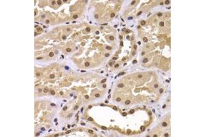 Immunohistochemistry of paraffin-embedded human kidney using CSRP2BP antibody (ABIN5975516) at dilution of 1/100 (40x lens). (CSRP2BP 抗体)