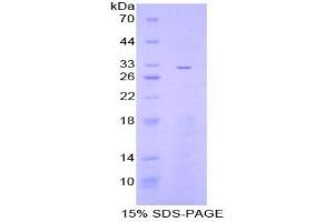 SDS-PAGE analysis of Mouse IkBz Protein. (Inhibitory Subunit of NF-KappaB zeta 蛋白)