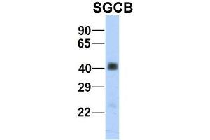 Host:  Rabbit  Target Name:  SGCB  Sample Type:  Human Fetal Heart  Antibody Dilution:  1. (SGCB 抗体  (Middle Region))
