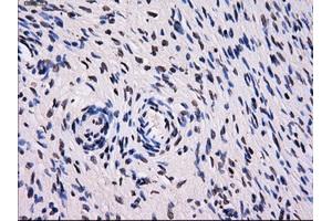 Immunohistochemical staining of paraffin-embedded Ovary tissue using anti-SORDmouse monoclonal antibody. (SORD 抗体)