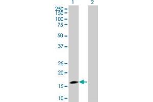 Western Blotting (WB) image for RGS3 293T Cell Transient Overexpression Lysate(Denatured) (ABIN1333312)