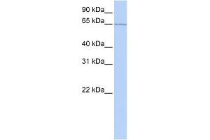WB Suggested Anti-KIAA0020 Antibody Titration:  0. (KIAA0020 抗体  (Middle Region))