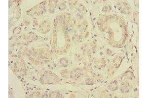 Immunohistochemistry of paraffin-embedded human salivary gland tissue using ABIN7151506 at dilution of 1:100 (SLC4A8 抗体  (AA 1-300))