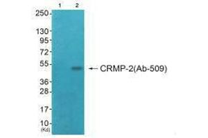 Western blot analysis of extracts from COS7 cells (Lane 2), using CRMP-2 (Ab-509) antiobdy. (DPYSL2 抗体  (Thr509))