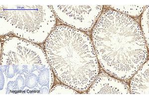 Immunohistochemical analysis of paraffin-embedded rat testis tissue. (Dynamin 1-Like 抗体)