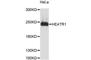 Western blot analysis of extracts of HeLa cells, using HEATR1 antibody (ABIN6290508) at 1:3000 dilution. (HEATR1 抗体)