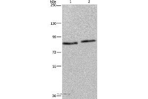 Western blot analysis of 293T and K562 cell, using ITGB2 Polyclonal Antibody at dilution of 1:600 (Integrin beta 2 抗体)