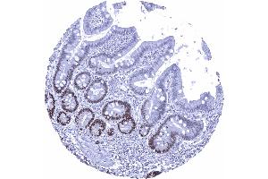Duodenum mucosa (Recombinant SOX9 抗体  (AA 393-508))