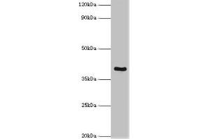 Western blot All lanes: Tumor necrosis factor receptor superfamily member 10D antibody at 2 μg/mL + Mouse liver tissue Secondary Goat polyclonal to rabbit IgG at 1/10000 dilution Predicted band size: 42 kDa Observed band size: 42 kDa (TNFRSF1D (AA 257-386) 抗体)