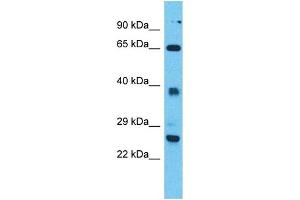 Western Blotting (WB) image for anti-Tetratricopeptide Repeat Domain 26 (TTC26) (N-Term) antibody (ABIN2500795) (TTC26 抗体  (N-Term))