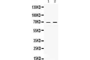 Observed bind size: 69KD (c-Rel 抗体  (Middle Region))