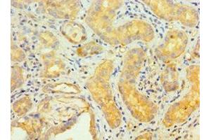 Immunohistochemistry of paraffin-embedded human kidney tissue using ABIN7173838 at dilution of 1:100 (TNFRSF1D (AA 257-386) 抗体)