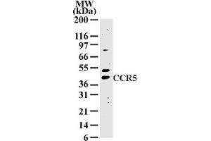 Image no. 1 for anti-Chemokine (C-C Motif) Receptor 5 (CCR5) (AA 324-340) antibody (ABIN208379) (CCR5 抗体  (AA 324-340))