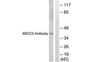 Western blot analysis of extracts from HepG2 cells, treated with Adriamycin 0. (RCC3 (AA 41-90) 抗体)